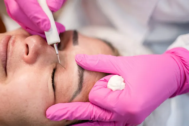 Profissional aplicando tratamento na região das pálpebras