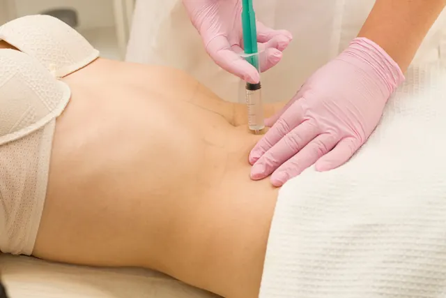 Profissional com luvas marcando a região do abdômen para procedimento corporal